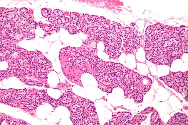 fat_cells_wikipedia_640x427