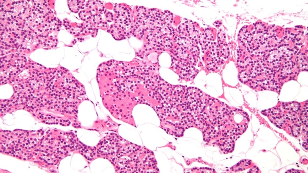 fat_cells_wikipedia_640x427
