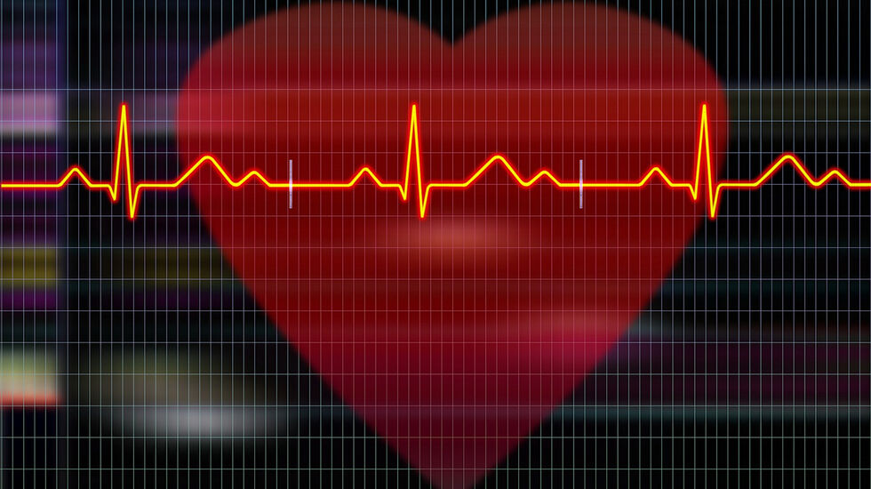 I den nye undersøkelsen vil forskerne prøve å finne ut hva slags trening som fungerer best hvis en sliter med atrieflimmer. (Foto: Pixabay)
