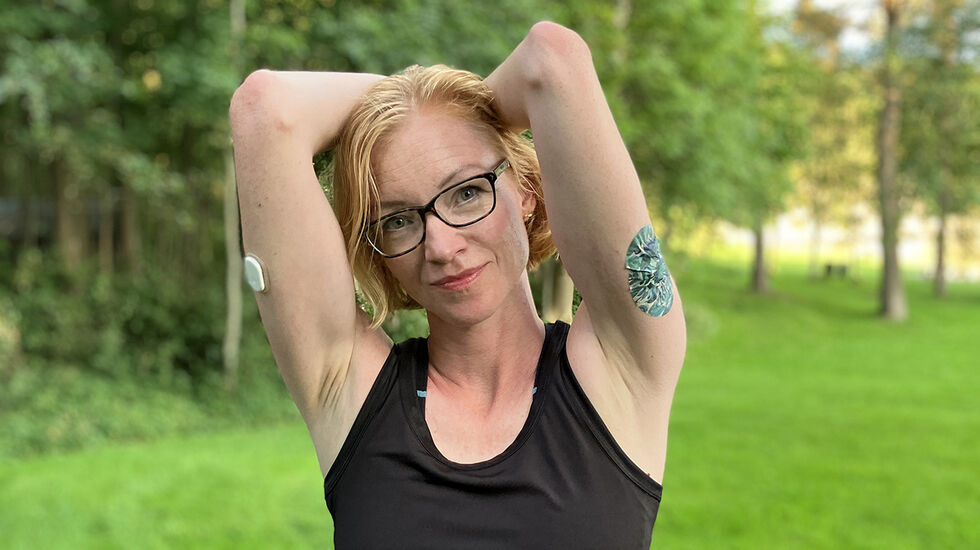 Diabetiker Eirin Winje har med seg en del ekstra utstyr når hun skal ut på lang løpetur. (Foto: privat)