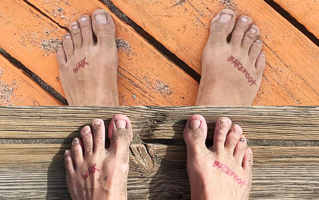 Før og etter: Det øverste bildet er tatt før Christina begynte å trene stortåa som følge av en plantar fascitt-skade i 2020. Det nederste bildet viser foten av i dag – etter opptreningen. (Foto: Christina Forstrønen Bruarøy)