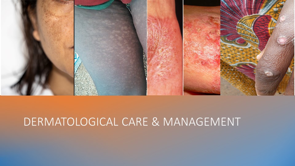 Dematology Many Skin Diseases