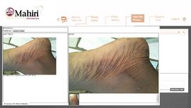 JOHN`S FOOT FOR WEBPAGE