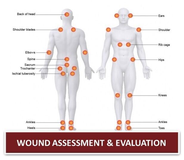 Wound Assessment & Evaluation