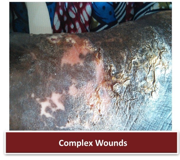 Complex Wounds 2 - 300424.jpg