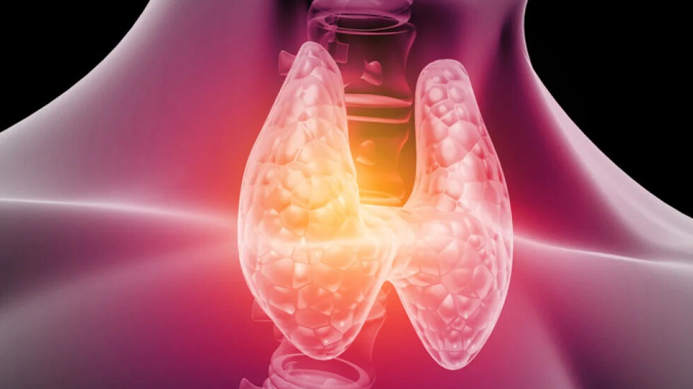 Innsenderen sliter med å få trent som hun vil som følge av betent skjoldbruskkjertel. Er det noen Kondis-lesere som har erfaring med dette, er det bare å ta kontakt med henne. (Foto: iStockphoto)