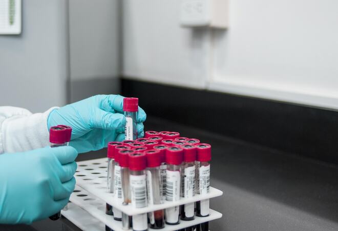 På bilde: Blodprøveglass på laboratorium.